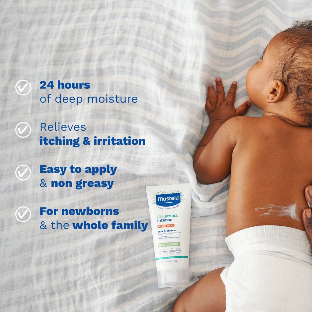 Mustela Stelatopia Intense - Non-Corticosteroid Cream | 30 ml